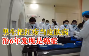 男生红疹当皮肤病治6年发现是癌症：医生用潜水服遮挡进行放疗