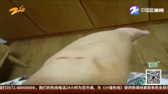 妻子想搭丈夫车上班  竟遭家暴
