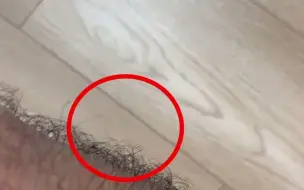 纯天然防蚊“神器”！男子腿毛太长 蚊子连叮五六次失败