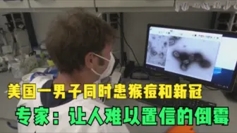 美国一男子同时患猴痘和新冠 专家：让人难以置信的倒霉