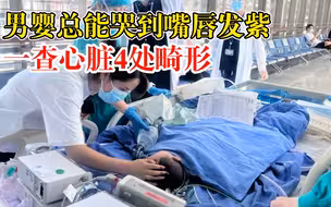 男婴总哭到嘴发紫一查心脏4处畸形：2年开胸2次，幼小却顽强