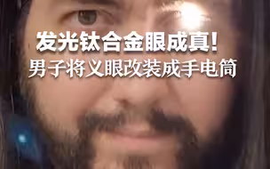 发光钛合金眼成真！美国一男子将义眼改装成手电筒