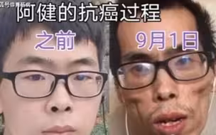 【医学科普】抗癌网红“阿健”走了，肠癌真的没有早期症状吗？