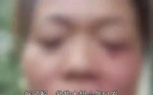 爱心大姐为救狗 一月被咬伤十几次，还卖掉184平米的房子：值得！