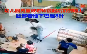 幼儿园男童被老师提起后扔到地上 脸部着地下巴缝8针