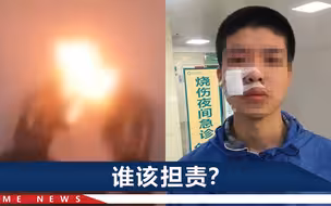 武汉15岁男生校内表演烧伤脸，班主任：是他硬要上台，跟我可没关系