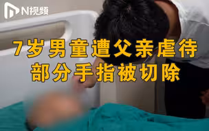 广东茂名遭父亲虐待男童接受部分手指切除手术！妇联已介入