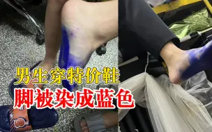 男生穿特价拖鞋脚被染成蓝色，舍友：开水泡2天才洗掉