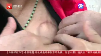 杭州师范大学附属医院：给患者装心脏起搏器没效果  只是为了“预防”猝死？