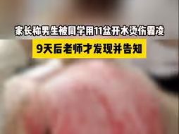 家长称男生被同学用11盆开水烫伤霸凌，9天后老师才发现并告知