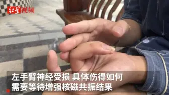 帮朋友“拉架”18岁少年被刺伤 曾是乐山市射击运动员