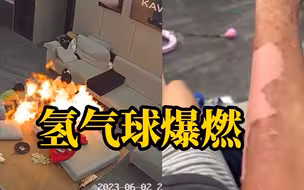 小孩玩氢气球时碰到吹风机瞬间爆燃，妈妈被烧伤