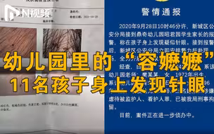 呼和浩特幼儿园被针扎孩子家长：孩子以为被扎正常没主动告知
