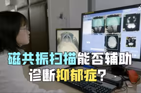 磁共振扫描能否辅助诊断抑郁症？