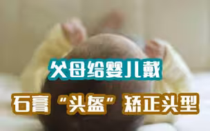 又交智商税！成人整容还不够，婴儿也要戴“头盔”矫正头型