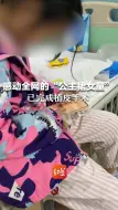 感动全网的“公主裙女童”已完成植皮手术 女童母亲：她期待出院穿上公主裙