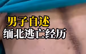 追债反被欠债人2万5卖到缅北：被长枪指头，跳楼逃跑摔成炸裂性骨折