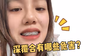 整牙八个月，我变成了深覆合。