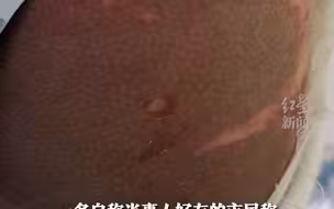 地铁车厢内有儿童被硫酸灼伤！广州警方：嫌疑人已被控制。