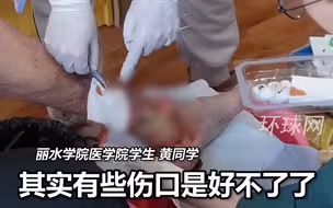 医学生利用暑假时间，自费给日军细菌战受害老人清创