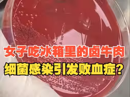 女子细菌感染引发了败血症，竟因吃了冰箱里的卤牛肉?