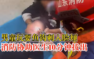车内放渔具男童玩耍鱼钩刺入脸颊，消防协助医生10分钟拔出