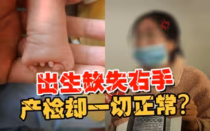 5次产检全部正常 宝宝却右手畸形 宝妈：医生的解释太荒谬