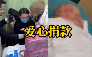 父亲取头皮救儿子后续：网红“国岳夫妇”50万捐款送到医院