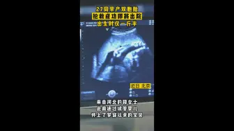 27周早产双胞胎抢救成功即将出院，出生时体重仅一斤半！