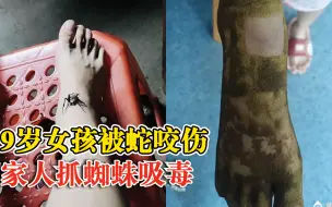 女孩被蛇咬伤奶奶抓蜘蛛吸毒：毒没吸出来，反而加剧毒性