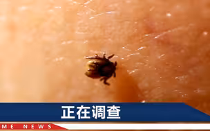嗜血成性！河南7旬老人患蜱虫病离世，3位村民为他净身后感染离世