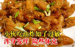小伙吃油炸知了猴过敏险休克：油炸知了虽美味，但不是谁都能吃