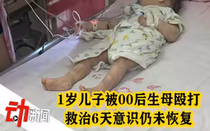 1岁男童被00后生母殴打致伤 救治6天意识仍未恢复