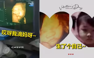 准妈妈临产前做彩超想看孩子长啥样 爸爸看到图像接连感叹笑喷网友