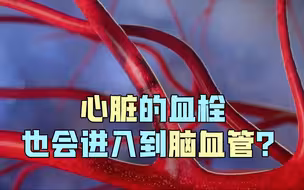 心脏的血栓也会进入到脑血管？