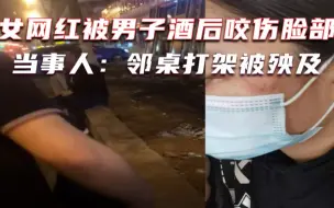 吉林女网红被男子酒后咬伤脸部,崩溃大喊