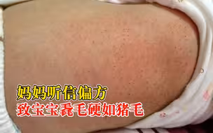 妈妈信偏方致宝宝毳毛硬如猪毛，医生：蛋清将毳毛粘在一起形成