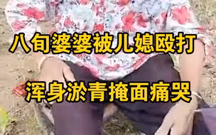 八旬婆婆被儿媳殴打，浑身淤青掩面痛哭