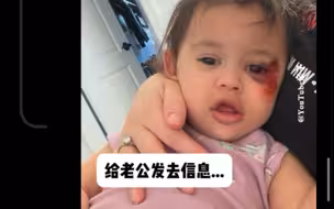 给女儿用受伤滤镜恶搞老公...看看他是啥反应🤭