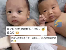 宝妈晒自家异卵双胞胎儿子 一个大眼睛双眼皮 一个小眼睛单眼皮