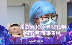 10个月大女婴反复咳嗽，外婆自行为孙女刮痧，致其面部溃烂！