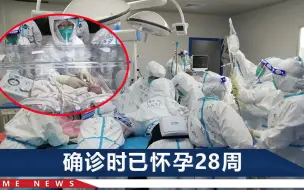 云南确诊新冠孕妇诞下三胞胎，曾一度发展为重型，孩子核酸检测报告公开