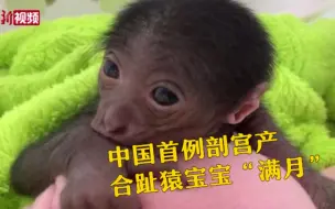 我国首例剖宫产合趾猿宝宝满月 萌萌哒！