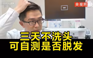 学到了！三天不洗头可在家自测是否脱发