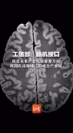 工信部：脑机接口将是未来产业发展重要方向，我国在该领域已形成全产业链